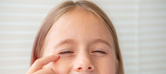 Uncomfortable Little girl squinting eyes, bright light sensitivity, discomfort irritation, dust in...
