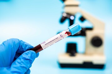 Fototapeta premium Measures apolipoprotein B levels, important for assessing