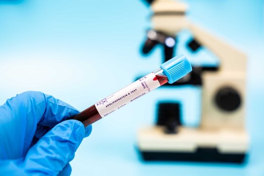Measures apolipoprotein B levels, important for assessing