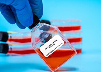 RNA Localization Studies Investigating how RNA molecules are