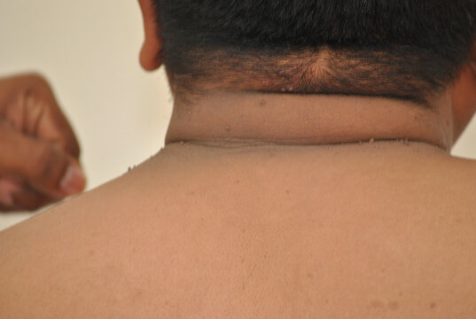 Anonymous Struggles: Overweight Man Hiding Behind a Cardboard Box