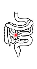 Understanding the causes and symptoms of abdominal pain and inflammation in the digestive system illustrating digestive tract health