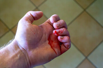A man's bloody hand with a visible finger wound, held above a floor with light ceramic tiles.