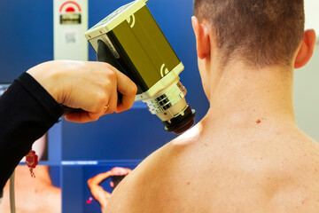 Digital dermatoscopy. Early diagnosis and prevention of skin cancer. Medical concept.