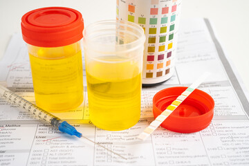 Urinalysis, urine cup with reagent strip pH paper test and comparison chart in laboratory.