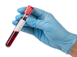Gloved hand holding blood sample in test tube
