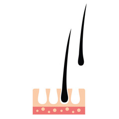 Hairloss vector illustration. Hairloss draw