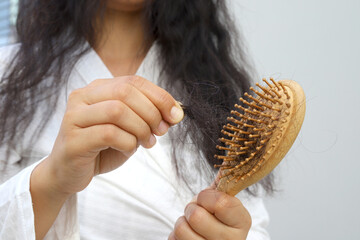 Hair loss in the center of the head or along the forehead