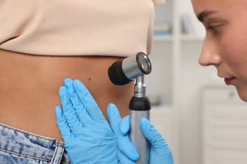 Doctor examining young woman's mole with dermatoscope in hospital, closeup