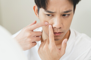 Asian men worry about acne on their faces when looking in the mirror