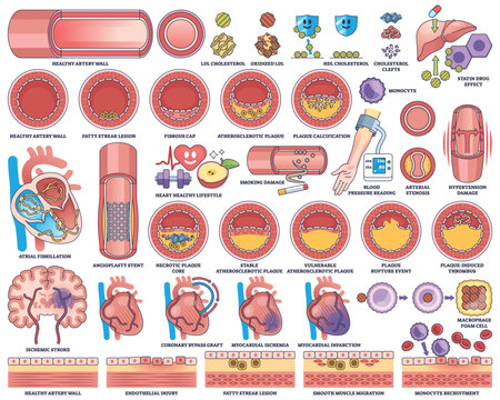 Atherosclerosis and cardiovascular disease are illustrated with artery cross-sections, heart diagrams, and plaque buildup. Outline style worksheet collection