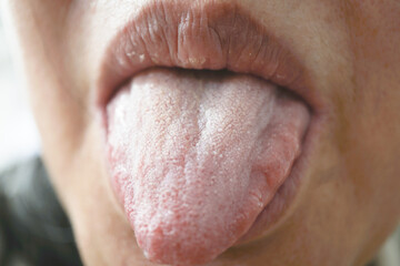 Close up image of person sticking out their tongue, showing texture and detail. focus is on mouth...