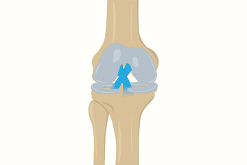 Illustration of human knee joint showing anterior and posterior cruciate ligaments. eps 10