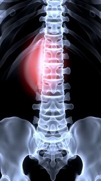 Detailed Blue and White Spine Illustration Highlighting Red Pain Area on Black Backdrop for Educational Medical Purposes