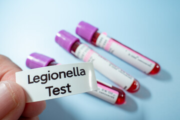 A gloved hand holds a blood sample tube labeled "Legionella Test"
