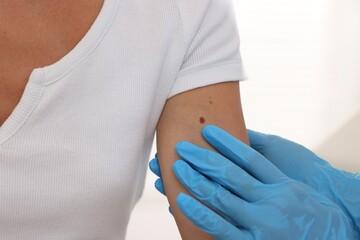 Doctor examining young woman's mole on white background, closeup