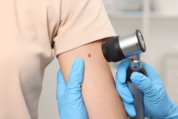 Doctor examining young woman's mole with dermatoscope in hospital, closeup
