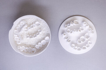 Dental models and tools displayed on a gray surface in a clinical environment for orthodontic...