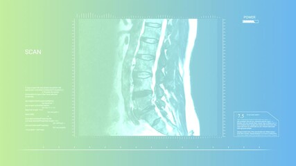 Advanced Diagnostic Interface Showing MRI Spine Scan with Animated Data, Code, and Power Indicators - Powered by Adobe
