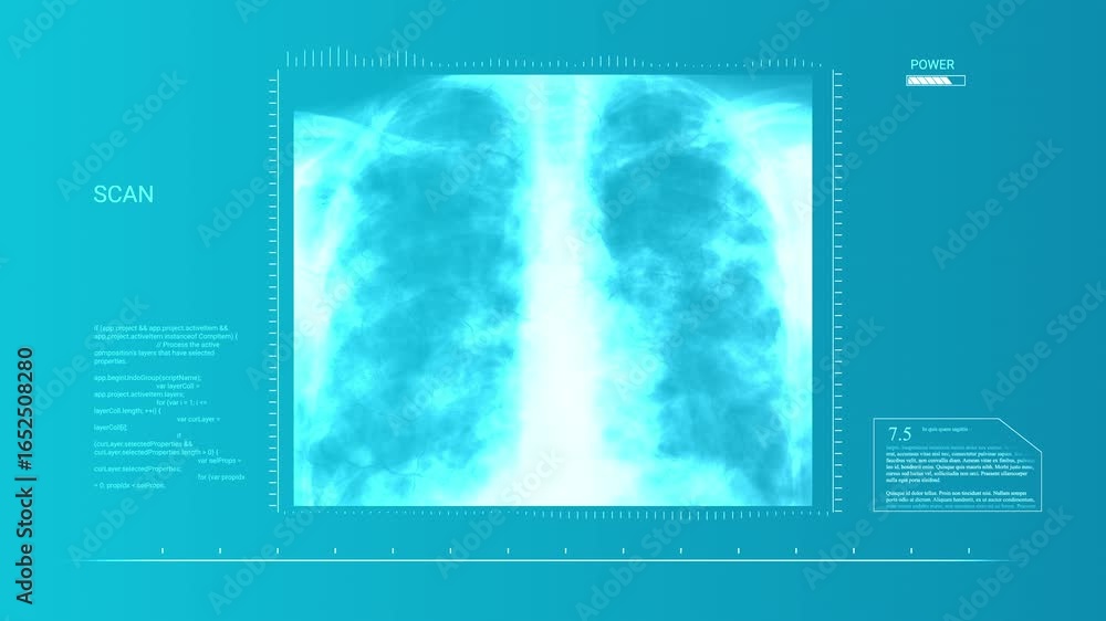 Poster advanced medical hud scanning human lungs with animated data and code analysis