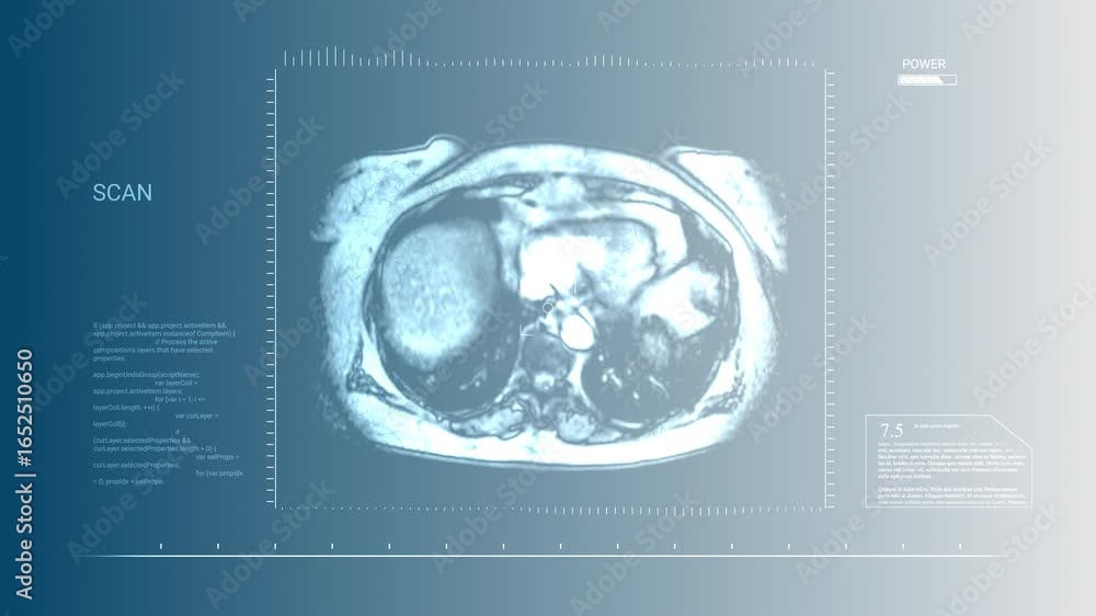 Poster dynamic medical mri scan of human abdomen with digital data interface and code analysis