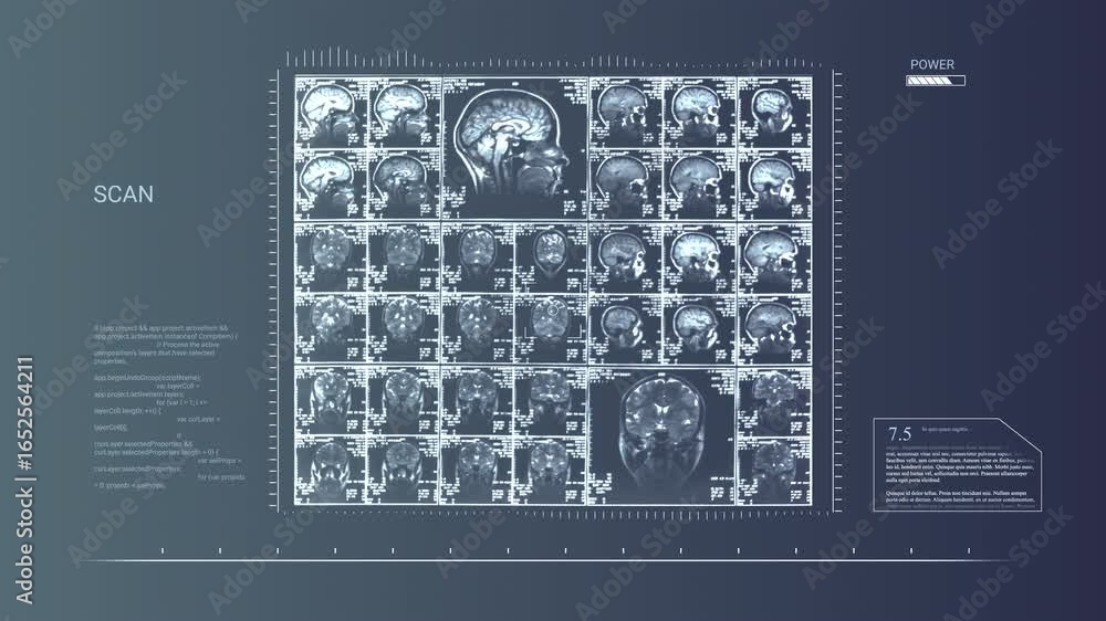 Poster medical scan interface: brain imaging, data analysis, and power loading sequence