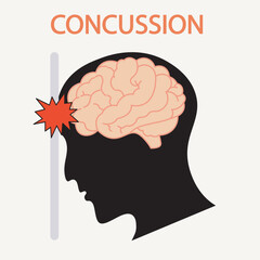 Flat vector illustration of concussion showing headache, dizziness, nausea, memory issues, with related disorders like migraine, whiplash, and post-traumatic head injuries. silhouette
