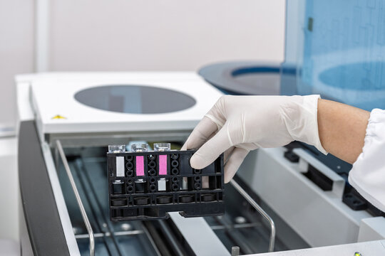 Close up scientist hand wear white gloves holding reagent control blood test with automatic machine in laboratory.Researcher analysis blood chemistry in medical laboratory. Medical healthcare