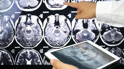 Senior Doctors analyzing Brain x-ray image on Digital Tablet in hospital. A Doctor Diagnosis with patient brain X-ray image scan on Digital Tablet. - Powered by Adobe