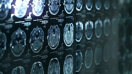 Scan of MRI check up of a patient's brain, closeup. Medicine, science and MRI brain background. doctor looking at patient brain magnetic resonance image. - Powered by Adobe