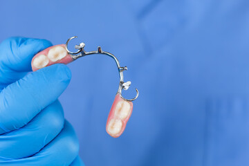 Close-up of a dentist's hand showing a removable cobalt-chromium partial denture. Dental health,...