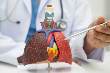 Pneumonia, lung cancer, Asian doctor holding human anatomy model for study diagnosis and treatment...