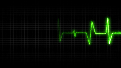 Green electrocardiogram waveform on a dark grid background