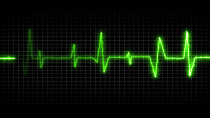 Green electrocardiogram waveform on a grid background