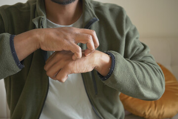 Man scratching his hand indoors in casual attire