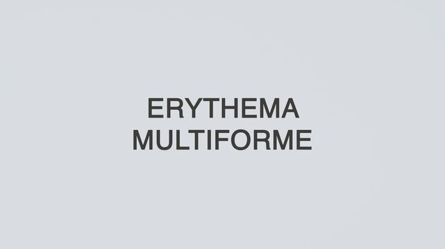 Erythema multiforme word diagnosed with a stethoscope held in hand on a white background, illustrating skin hypersensitivity reaction, medical evaluation, healthcare concept, and awareness