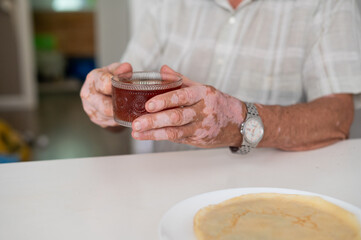 Vitiligo on the hands of an elderly man. Close-up of a man's hands holding a cup of tea. Autoimmune disease