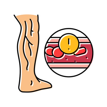 deep vein thrombosis cardiology disease color icon vector illustration