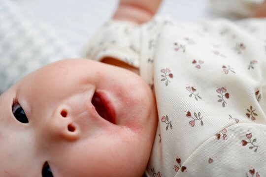 よだれかぶれで口周りが赤くなった5ヶ月の女の子の赤ちゃん