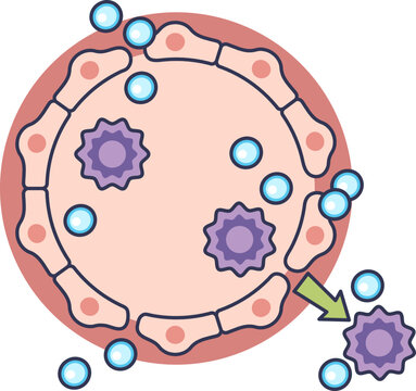 Illustration of vascular leakage during inflammation. An immune cell and plasma exit a blood vessel through gaps between endothelial cells, a result of vasodilation and increased permeability.