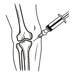 Knee joint injection therapy line art.