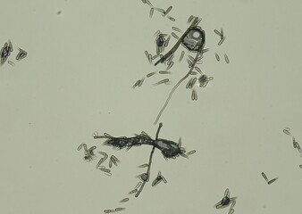 soil microorganisms under a microscope including amoeba, flagellates, nematodes, fungi, bacteria	