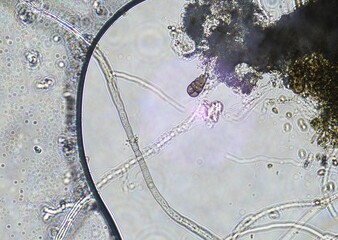 soil microorganisms under a microscope including amoeba, flagellates, nematodes, fungi, bacteria	