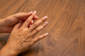 Office worker self-massaging finger due to repetitive strain injury (RSI); wooden desk setting...