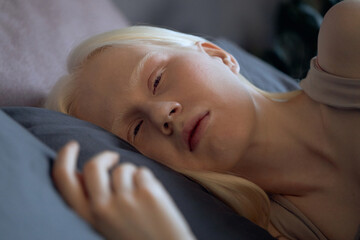 Horizontal close-up shot of young Caucasian woman with albinism relaxing in bed early in morning...