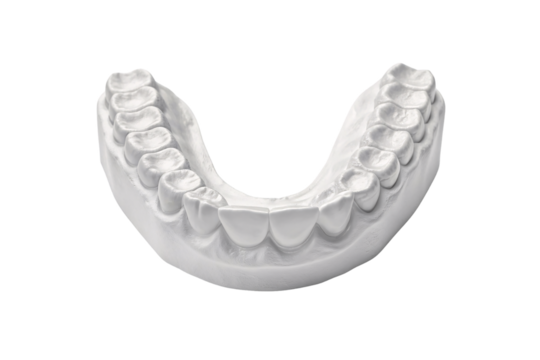 White plaster dental cast model of lower jaw with detailed tooth impressions, isolated on a transparent background