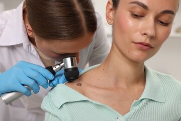Doctor examining young woman's mole with dermatoscope in hospital