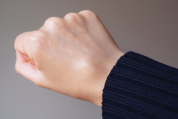 Female right back hand with ganglion cyst on the dorsum,  fluid-filled bump associated with a joint or tendon sheath, close-up view, selected focus.