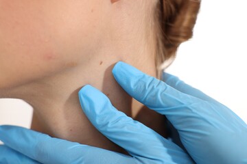 Doctor examining young woman's mole on white background, closeup