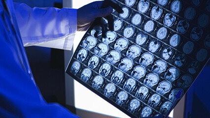 Doctor and x-ray. MRI of the head. X-ray. Doctor. High-quality photo.